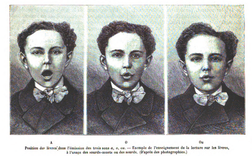Lip positions during articulation of the vowels A, O, and Ou, from: Felix Hement, “Les progrès récents dans l’enseignement des sourds-muets” (1885)  